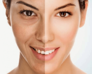 10 trucos antiarrugas para mantener una piel joven de forma natural