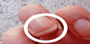 Uñas quebradizas: causas, vitaminas y remedios naturales para fortalecerlas