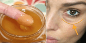 Cómo quitar las ojeras con aloe vera: remedios naturales y consejos efectivos