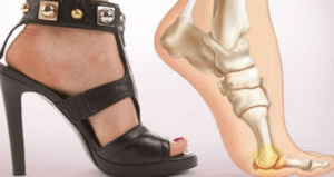Peligros de los tacones y cómo afectan al cuerpo!
